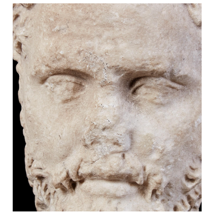 Roman Marble Head of a Bearded Man.  Roman Imperial Period, Late 2nd Century C.E.